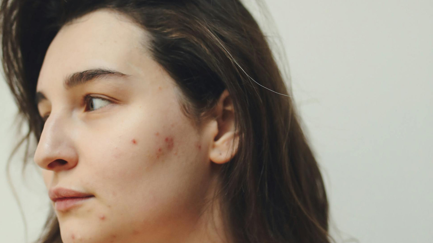 Stress und deine Haut: Einfache Schritte, die dir helfen, das Gleichgewicht wiederzufinden