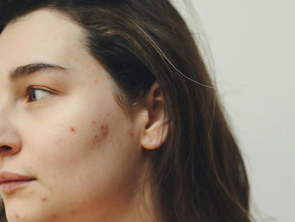 Stress und deine Haut: Einfache Schritte, die dir helfen, das Gleichgewicht wiederzufinden